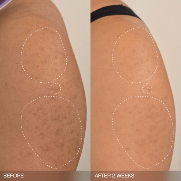 TOPICALS Slather Bar Savon Exoliant Lissant Anti-rugosités 2X – Image 3