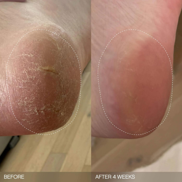 TOPICALS Slather Bar Savon Exoliant Lissant Anti-rugosités 2X – Image 2